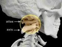 Upper cervical & brainstem area