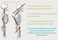 How the neck affects the low back