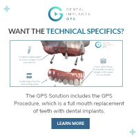 dental implant solution