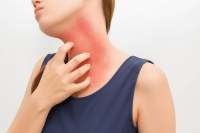 Allergy Treatment in Texas