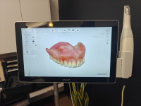 Digital Intraoral Scan using 3Shape TRIOS to make a Copy Denture