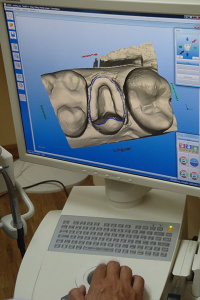 Cerec Machine at Longmont CO dentist Artistic Smiles