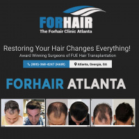 Hair Transplant Results