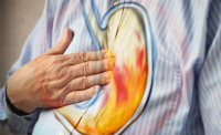 heartburn treatments