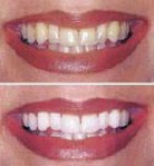 La Jolla Del Sur Dental