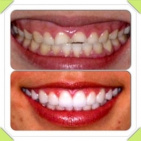 Beverly Wilshire Dental Group