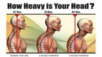 We correct poor spinal posture