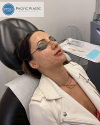 San Francisco Plastic Surgeon
