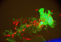 Our outstanding immunopathology work