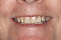 Dentist PRIMARY, Oral surgeon, Dental clinic