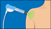 Shockwave Therapy