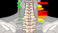 Abnormal thermal scan