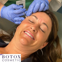 Smile for Botox!