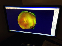 Optomap retinal screening available