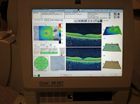 Retinal/Optic Nerve Scanning 7