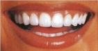 Dr. Benjamin Linden Young, DDS