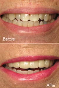 Smile Makeovers 8