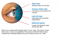 Dry Eye Treatments 6