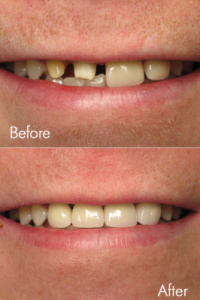 Smile Makeovers 14