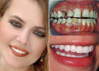 cosmetic reconstruction 1