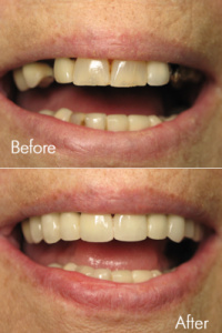 Smile Makeovers 11