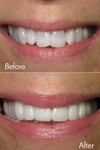 Smile Makeovers 13