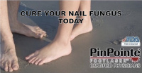 Cure your toenail fungus today! 1